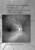 Detection and Screening for Glaucoma